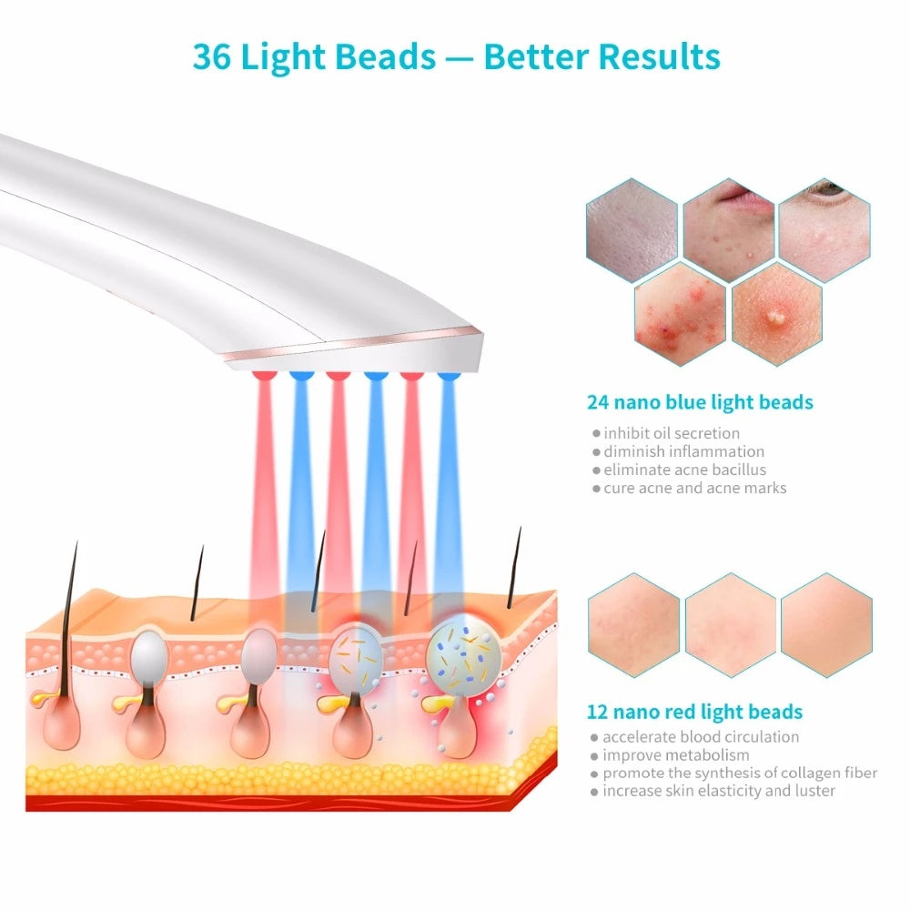 PureLight™ Acne Therapy Wand